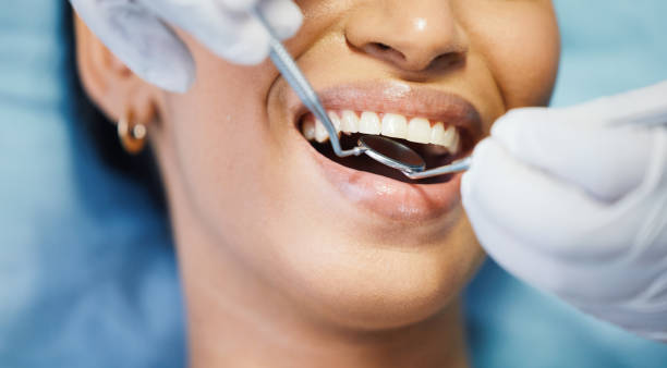 Best Pediatric Emergency Dentist in Oxnard, CA